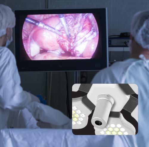 Camera Mounting Provision