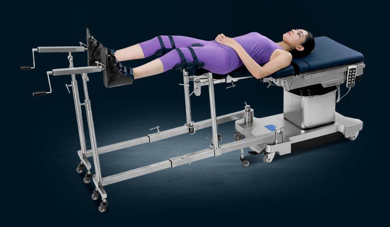 AM 01 Ortho Attachment